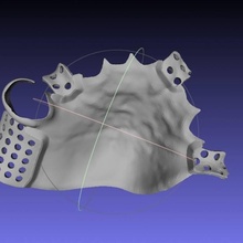kısmi protez partialdenture 3d print model - Mito3D