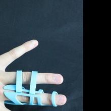 imakrthon entrada médicos dedo cinta acessibilidade louva deus imperialcollege fingerbrace 3d print model - Mito3D