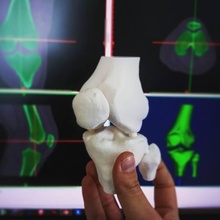 Knie ct Scan Bildung Anatomie 3d print model - Mito3D