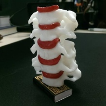 cervical vertebrae education bone human skull vertebra vertebral column 3d print model - Mito3D
