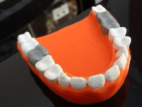 Zähne Silber Prothese Bildung Zahn Farbe Mund Kiefer Farben grau Mehrfarbig Mehrfarben 4 3d drucken Drucken 3d print model - Mito3D