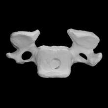 humano cervical vértebra escanear hueso 3d print model - Mito3D