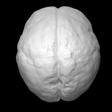 foetal brain 14 weeks education baby human 3d print model - Mito3D