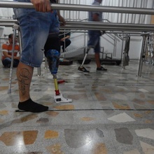 3d Stampa protesica piede accessibilità piedi protesi amputato 3d print model - Mito3D