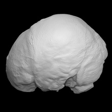 endocrânien jeter John Howison analyse cerveau meurtre john howison 3d print model - Mito3D