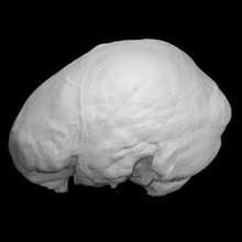 endocranica cast William Burke formazione scolastica anatomia cervello omicidio esecuzione endocranio william burke 3d print model - Mito3D