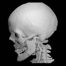 cabeza educación 3d anatomía esqueleto estructura médico escanear ct 3d print model - Mito3D