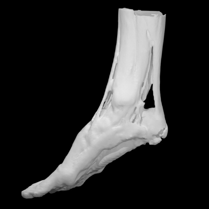 muscle tendon structure foot education 3d anatomy body medical scan ct 3D print model - Mito3D