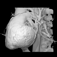 humano corazón educación anatomía cuerpo médico escanear ct 3d print model - Mito3D
