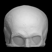 skull cast robert burns education anatomy scotland poet death robert-burns 3d print model - Mito3D