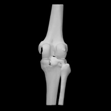 knee education anatomy body bone skeleton structure embodi3d 3d print model - Mito3D