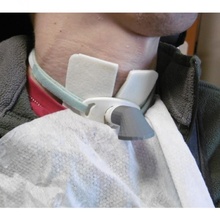 balgam deflektör trakeotomi Flecteur Crachats dökün trah otomie ulaşılabilirlik sağlık 3d print model - Mito3D