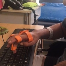 ortez yazıyor dokunmatik ekran ulaşılabilirlik el araçlar sakatlık handikap protez terapi meslekle 3d print model - Mito3D