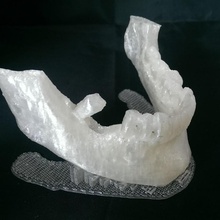 mandibula arquivo dicom educação ciência medicina mandíbula jawbone 3d print model - Mito3D