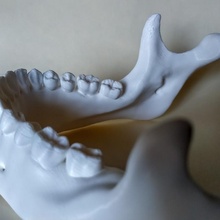 humano mandíbula dientes 3rd molar dental mandibula 3d print model - Mito3D