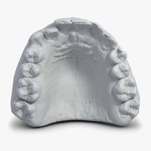 el yeso del molde de los dientes escaneo 3d la anatomía cuerpo carácter dantist dental dentadura goma mascar humanos médica modelo moho scan shiva3d 3d print model - Mito3D