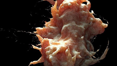 tumore delle cellule di cancro del cluster l'anatomia corpo cell carattere malattia umana infezione mammifero medico la medicina modello neoplasia operazione fisiologia scienza scyrus imbarcazione 3d print model - Mito3D