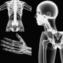 x-ray Skelett weiblich Anatomie Biologie Körper Charakter dna Arzt Mensch Labor Männlich Mann die medizinische Medizin michaeltaylor3d Modell ray Wissenschaft virus Frau x xray 3d print model - Mito3D