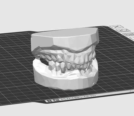 denti impostato lowpoly by dubmehard arte sculture dente anatomia anatomico scultura umano corpo 3d print model - Mito3D