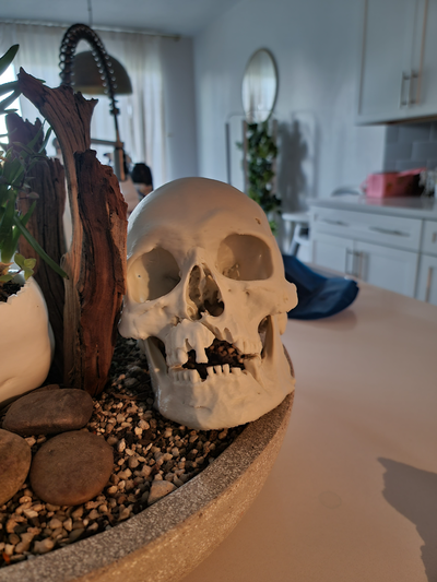 3d scan of skull injury 1361 war - swedish history museum remixed by jayray education biology halloween decor axe 3d print model - Mito3D