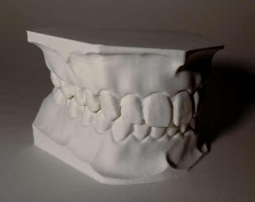 dental modelo superior dentes conjunto by tchau miniaturas varredura médico 3dscan dentista dentaduras 3d print model - Mito3D