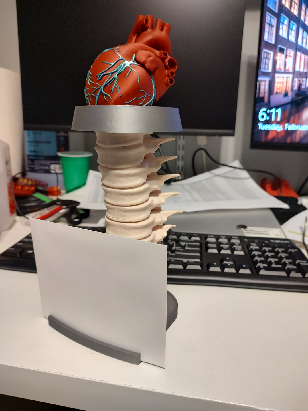 kalp resim çerçeve by yedoggie sanat modeller kulp destek tıbbi 3D print model - Mito3D