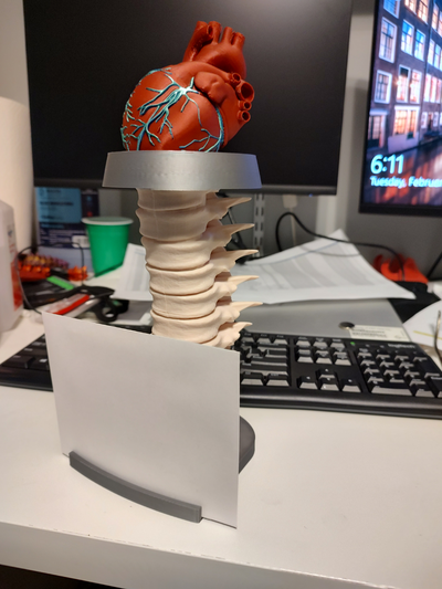 kalp resim çerçeve by yedoggie sanat modeller kulp destek tıbbi 3d print model - Mito3D