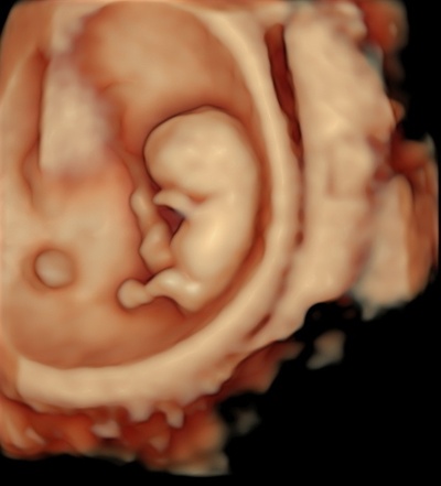 naître bébé 8 semaines forme d'épingle 3d print model - Mito3D
