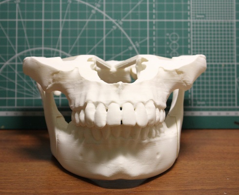 human jaws pinshape skull 3d print model - Mito3D