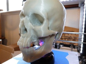 cráneo humano resonancia magnética pinshape ic3d imprimir ganar concurso 3d print model - Mito3D