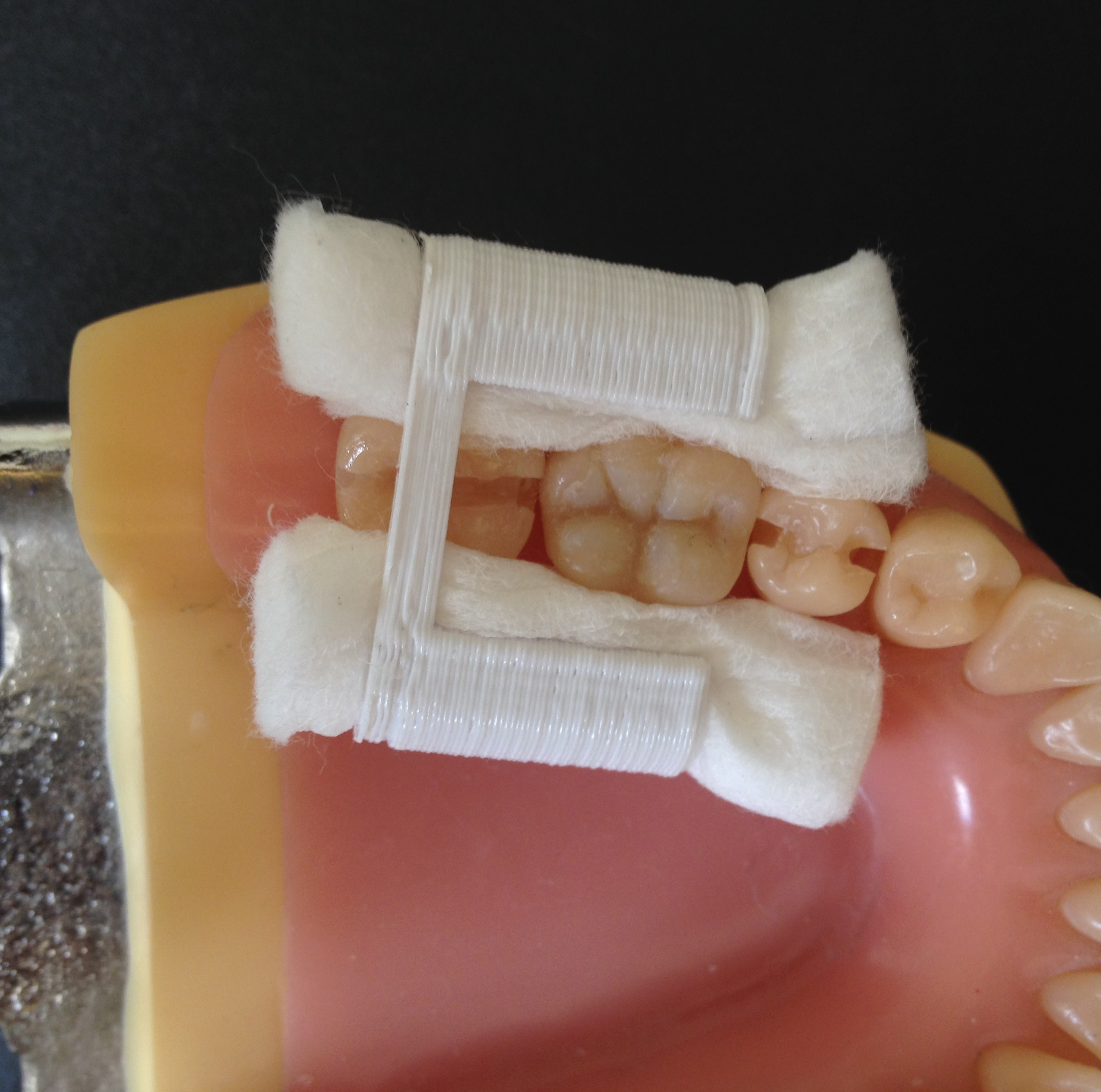 algodón portarrollos suportes rolo algod pinshape rolete suporte dentes dente odontologia relativo isolamento dentistica dentista odontología pariente aislamiento titulares rollo dientes diente 3D print model - Mito3D