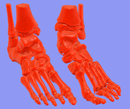 foot bone pinshape dicom ct-scan 3d print model - Mito3D