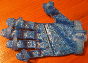 external extensor exoskeleton pinshape within-reach-3d-design-challenge-18-and-over 3d print model - Mito3D