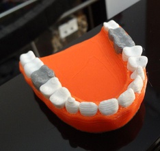 denti d'argento protesi pinshape disegno 3d 3d print model - Mito3D