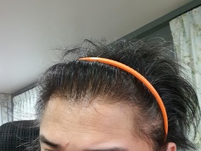 Haar Band Pinshape Haarband 3d print model - Mito3D