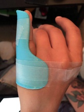 pinky splint pinshape immobiliser aid finger fingers brace 3d print model - Mito3D