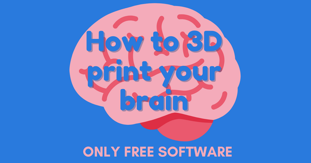 3d print brain max siebenschl fer download free stl model printablescom models art & design sculptures mrt 3d print model - Mito3D