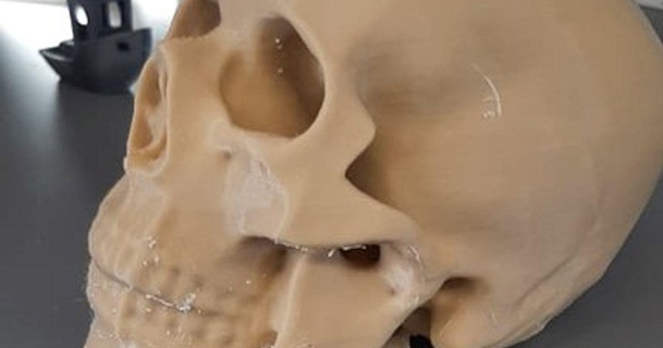3d scanné Humain crâne peter Télécharger libre stl modèle imprimablescom modèles monde scans 3dscanner anatomie 3d print model - Mito3D