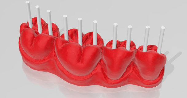 supporter dentaire exercices Thorin oakenshield Télécharger libre stl modèle imprimablescom 3d modèles soins santé médical outils 3d print model - Mito3D