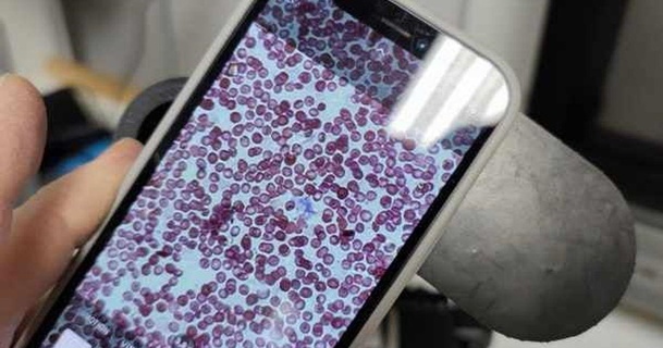 seyyar kamera mikroskop ayırıcı spotmatik 3D modeller öğrenme kimya Biyoloji şeytani cep telefonu 3d print model - Mito3D
