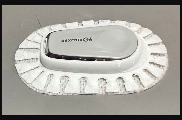 dexcom g6 tpu startseite mantel remix by witzlos download frei stl modell druckbares 3d modelle gesundheitswesen zuhause haus medizinisch werkzeuge dexcomcgm dexcomg6 3d print model - Mito3D
