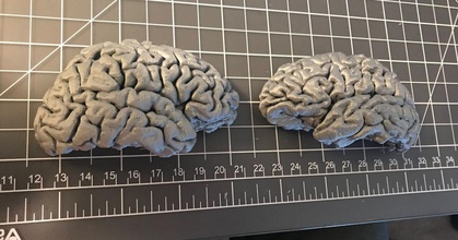 Humain cerveau hémisphères mri données excité Télécharger libre stl modèle imprimablescom 3d modèles monde scans 3d print model - Mito3D