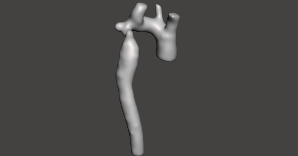 coarctation aorte Austin Quinn Télécharger libre stl modèle imprimablescom 3d modèles monde scans anatomie ct analyse segmentation 3d print model - Mito3D