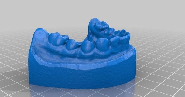 ensemble dents dentaire modèle 3d analyse tester raspi came openscan Télécharger libre stl imprimablescom modèles monde scans 3dscanner 3dscanning anatomie 3d print model - Mito3D