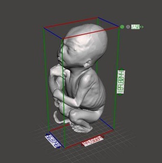 16 settimana fetale bambino riproduzione gollum rossa 3d print model - Mito3D