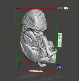 20 week fetal baby reproduction highly wrinkled redpah 3d print model - Mito3D