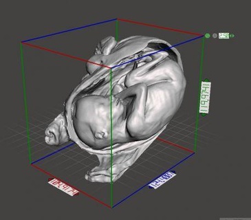 30 week fetal baby reproduction uterus redpah 3d print model - Mito3D
