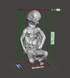 36 semaine fœtal bébé reproduction vrai cyclope redpah 3d print model - Mito3D