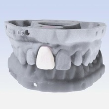 dijital kesici diş kaplama Yazdır hazır 3d model 3d print model - Mito3D