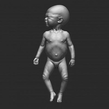 yeni doğan bebek anatomi 1 durum 3 Yazdır hazır 3d model rbonnacoelho 3d print model - Mito3D